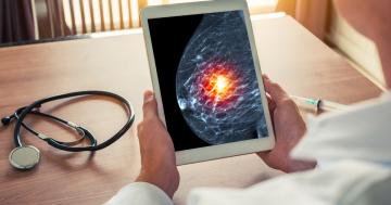 Aplicação dos DRs é aprovada para os exames de Mamografia Digital Direta