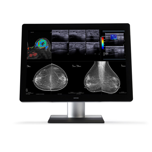 Monitor de Diagnótico para Mamografia Coronis Uniti MDMC-12133 Barco - Konimagem