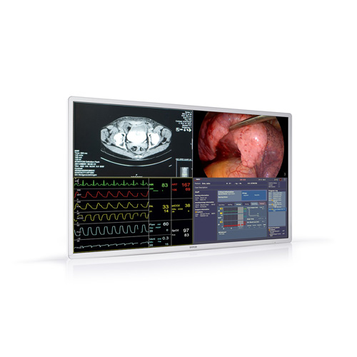 Monitor Cirúrgico MDSC-8255 Barco - Konimagem