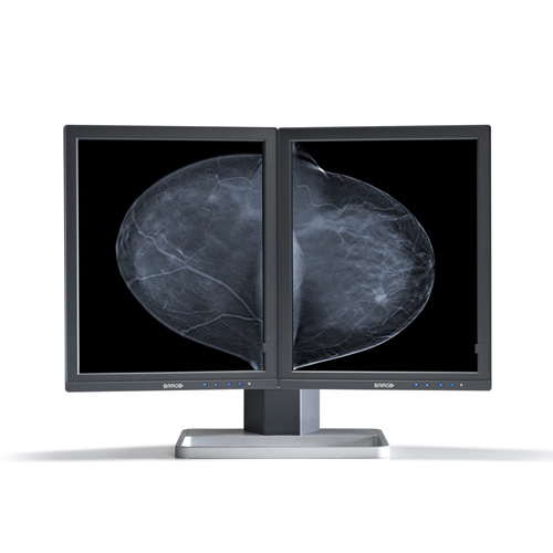 Monitor de Diagnótico para Mamografia 5MP MDMG-5221 Barco - Konimagem