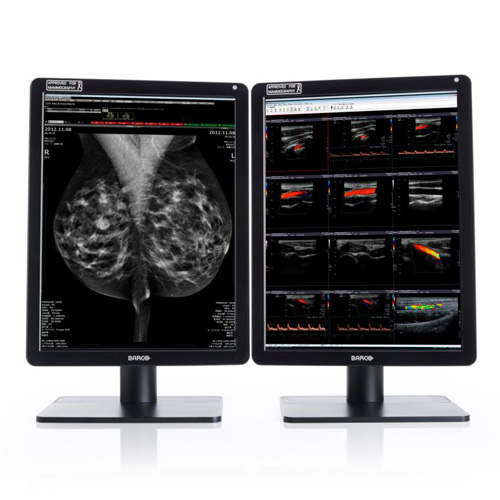 Monitor de Diagnótico para Mamografia Nio Color 5MP MDNC-6121 Barco - Konimagem