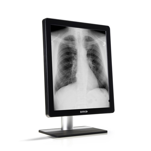 Monitor de Diagnótico para Mamografia Nio 5MP Led MDNG-5221 Barco - Konimagem
