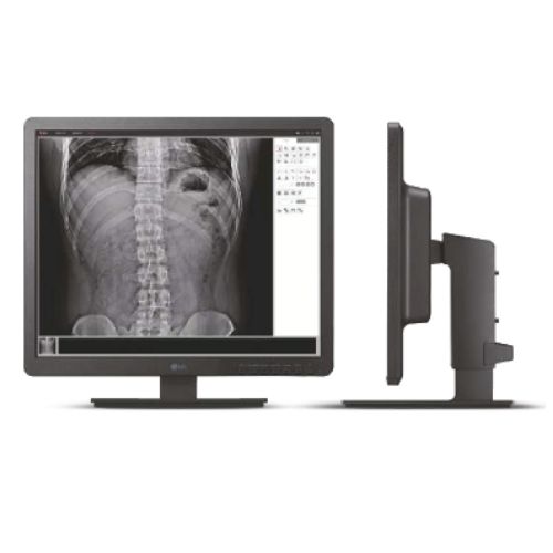 Monitor Diagnóstico LG 19” 1.3MP 19HK312C - Konimagem